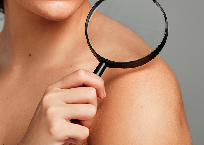 Papel da microbiota-da pele nas doencas