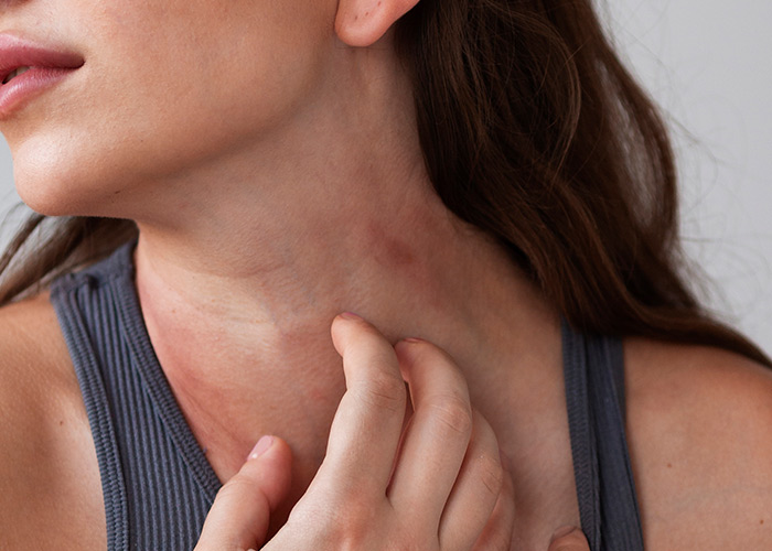 Doença inflamatória crônica da pele