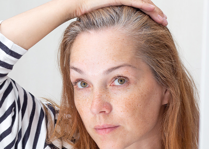 A alopecia e a microbiota intestinal