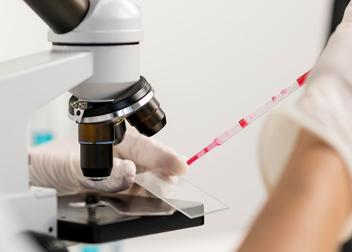 Síndrome retroviral aguda