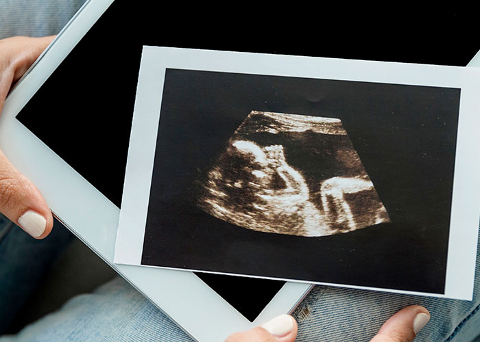 Software para identificação de sofrimento fetal