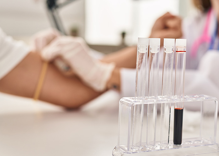 Procedimentos que o regulador usará