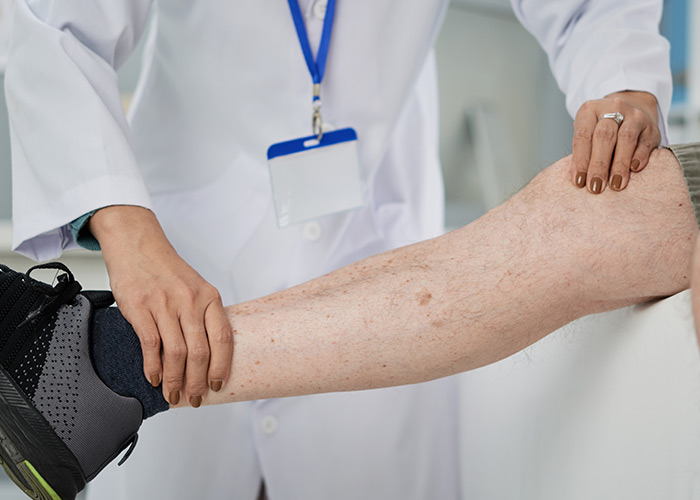 Formação de coágulos