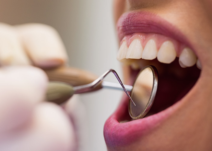 LcS na microbiota da placa dentária