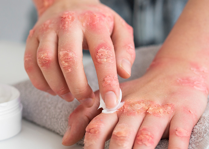 Pele saudável e protegida