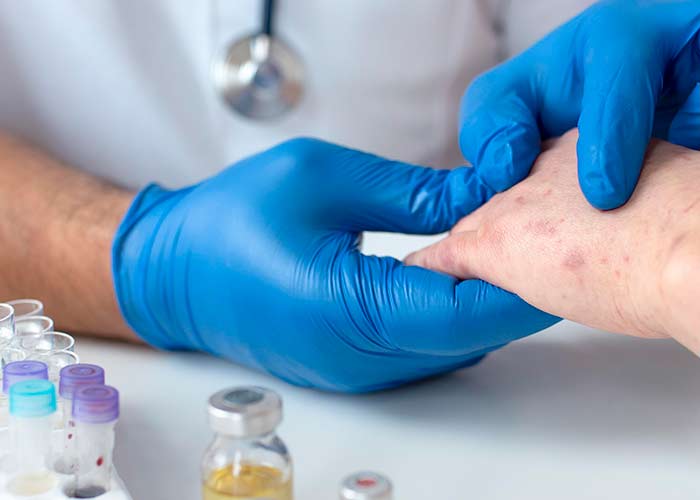 Melanoma cutâneo