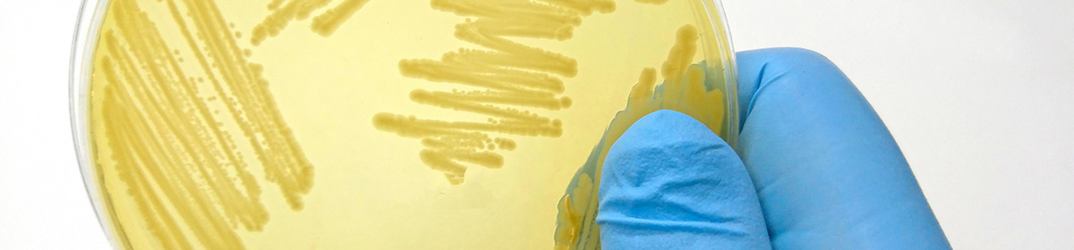 Doença de Parkinson