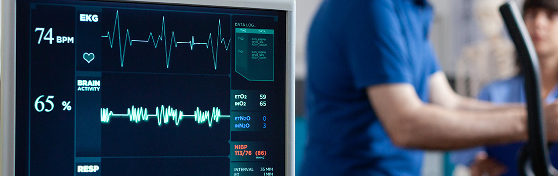 Arritmias cardíacas