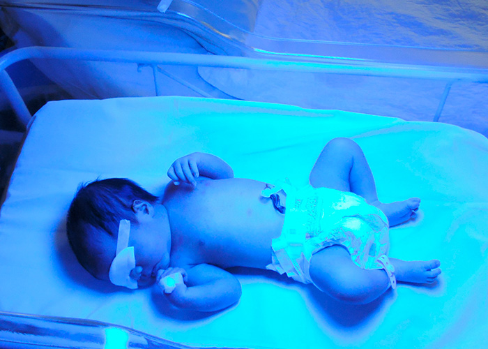 Condição genética rara