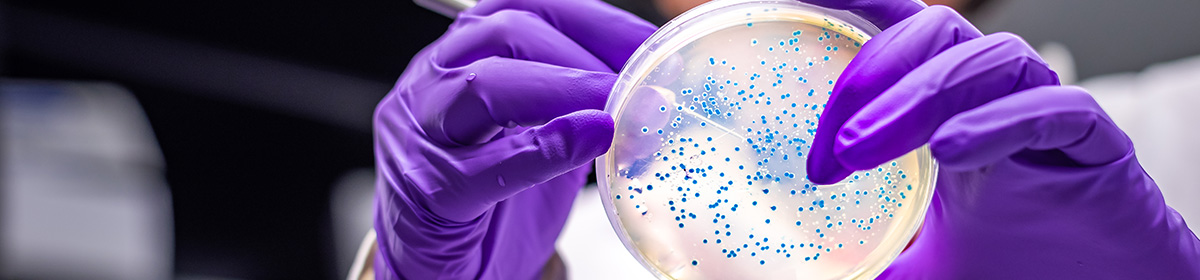 Microbioma geniturinário