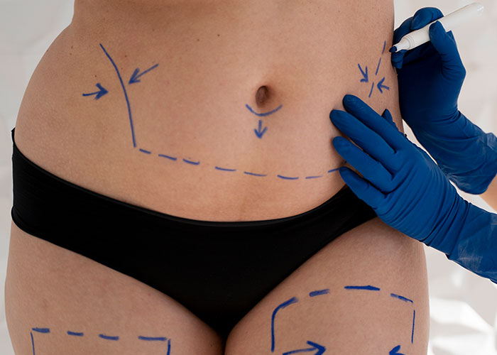 Cuidados no pré e pós-operatórios