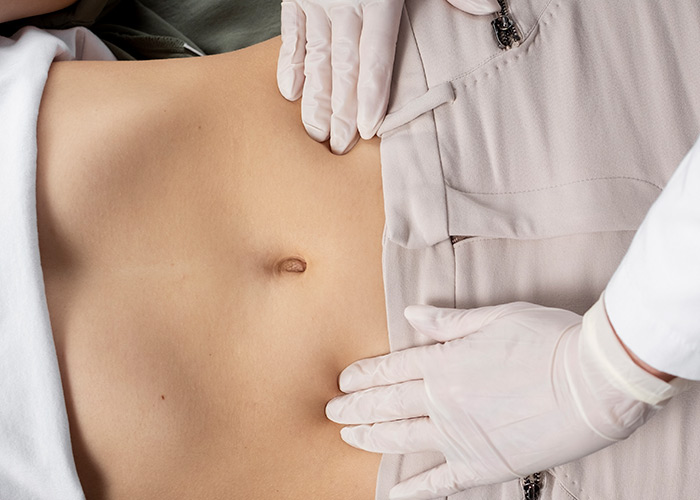 Cirurgia bariátrica