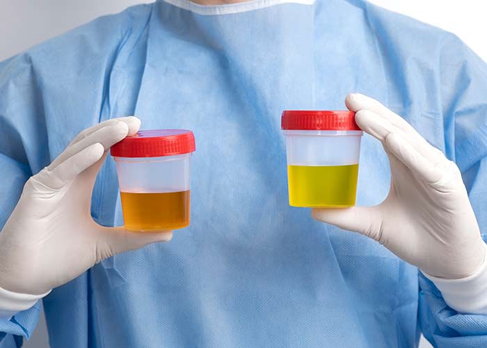 Infecções do trato urinário
