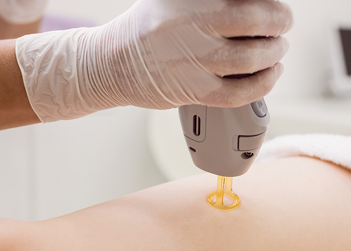 Regeneração dos tecidos