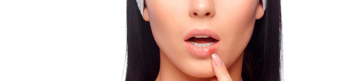 Vírus varicela-zoster