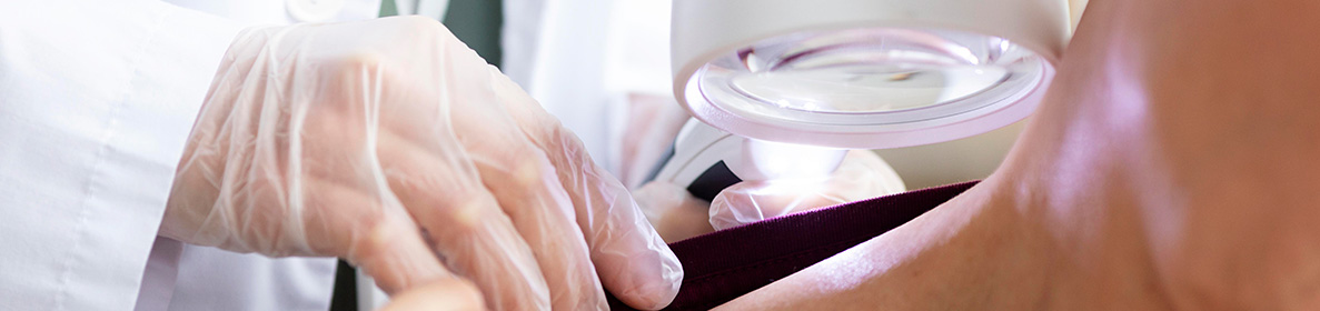 Cirurgia micrográfica de Mohs