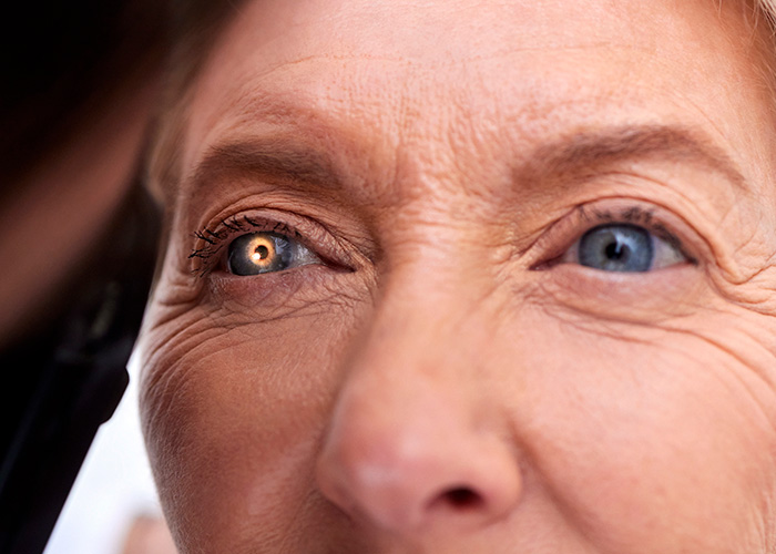 Envelhecimento precoce dos olhos