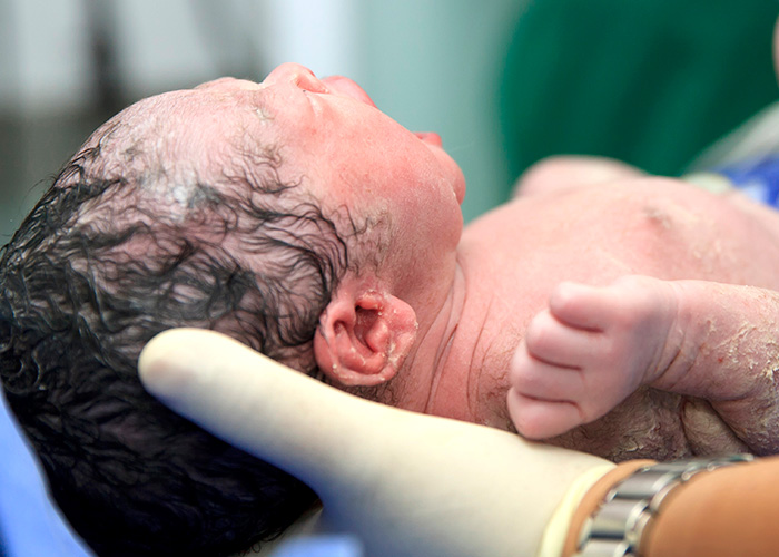 Sepse neonatal precoce