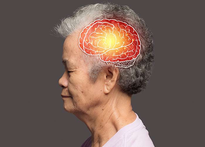 gatilho-na-progressao-do-alzheimer