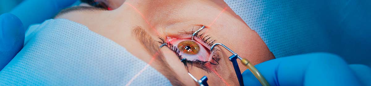 Implante de microlente intraocular