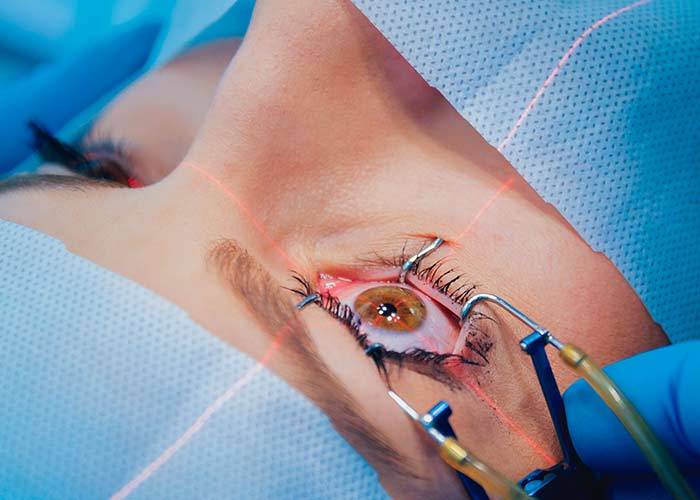 Implante de microlente intraocular