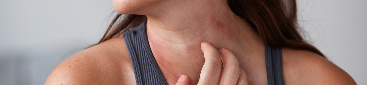 Alergia alimentar