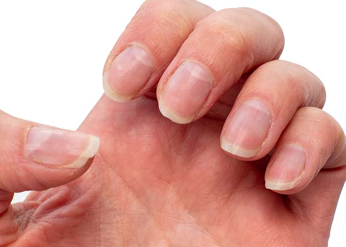 Tecidos ao redor das unhas