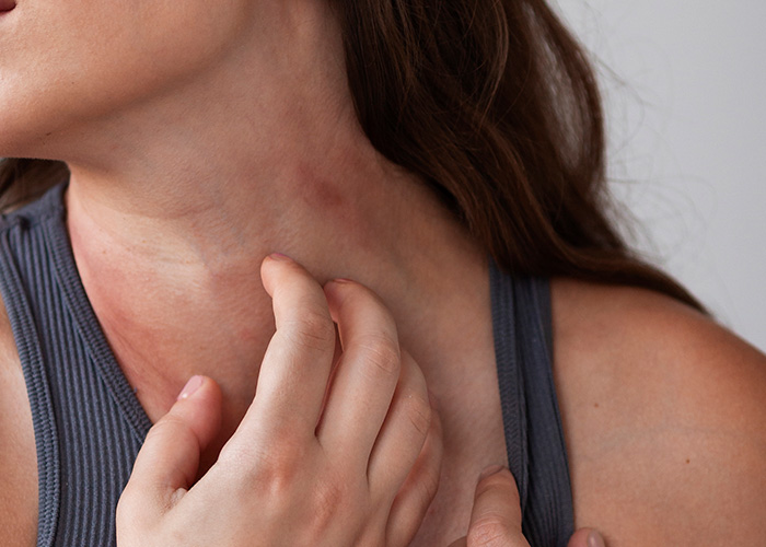 Alergia alimentar