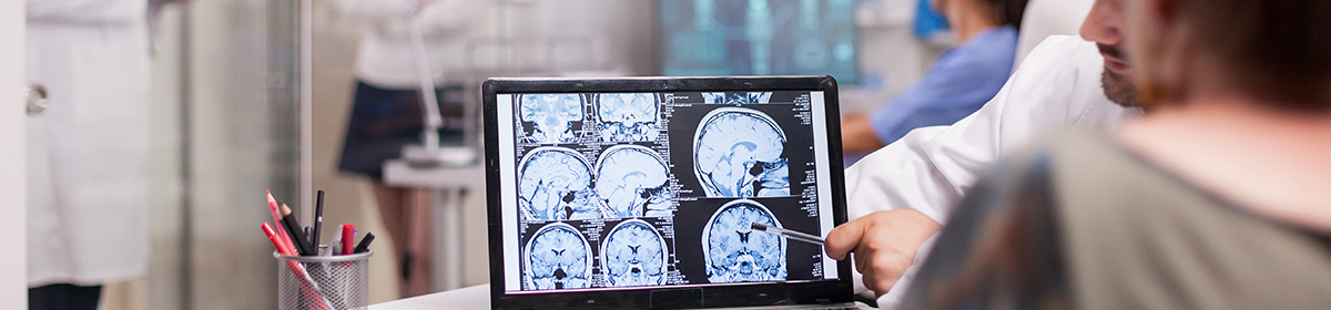 sinais-de-tumor-cerebral-vao-alem-da-dor-de-cabeca