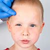 destaque-super-saudavel-materia-da-edicao-home-a-alergia-alimentar-na-infancia-exige-atencao