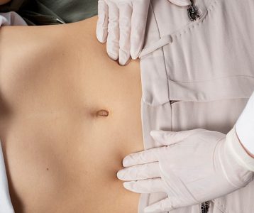 Cirurgia bariátrica