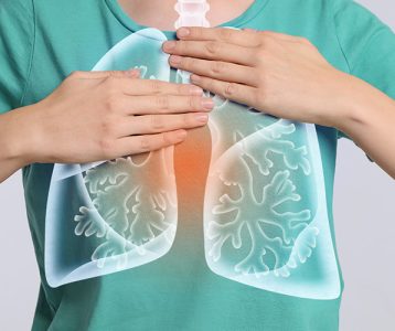 Microbiota pulmonar e disbiose intestinal