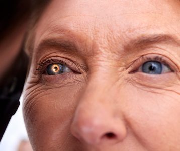 Envelhecimento precoce dos olhos