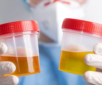 Cor da urina informa sobre a saúde