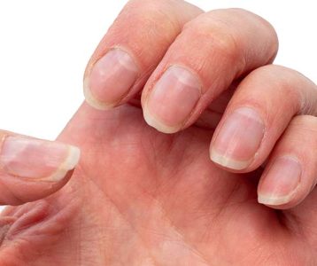 Tecidos ao redor das unhas