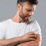 super-saudavel-mareia-da-edicao-a-dermatite-atopica-demanda-cuidado-multidisciplinar Dermatite atópica