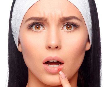 Vírus varicela-zoster