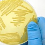 Doença de Parkinson