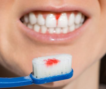 Manifestações clínicas