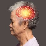 gatilho-na-progressao-do-alzheimer