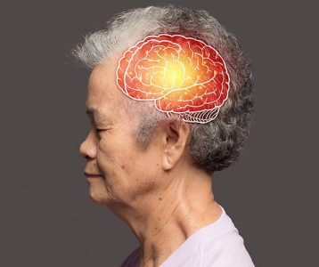 gatilho-na-progressao-do-alzheimer