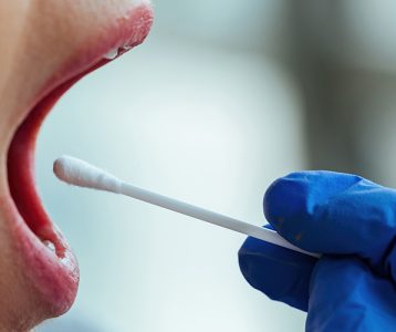 Methanobrevibacter oralis