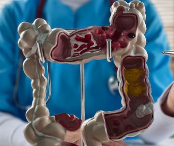 Análise multiômica