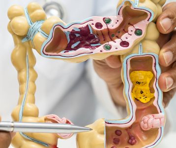 Transplante de microbiota fecal