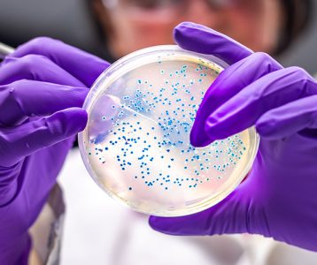 Microbioma geniturinário