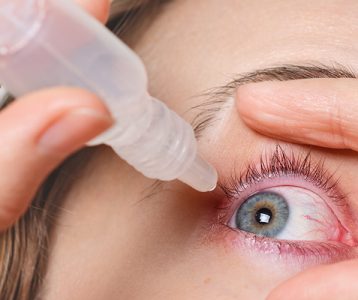 Conjuntivite viral
