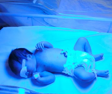 Condição genética rara