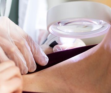 Cirurgia micrográfica de Mohs