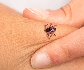 Cardiomiopatia chagásica crônica